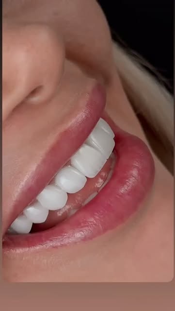 Smilers Dental Clinique